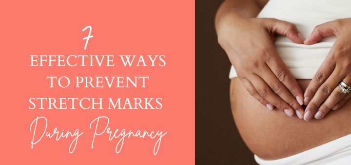 how to prevent pregnancy stretchmarks
